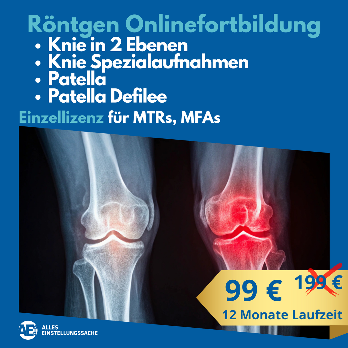 Knie in 2 Ebenen, Knie Spezialaufnahmen, Patella und Patella Defilee - Alles Einstellungssache